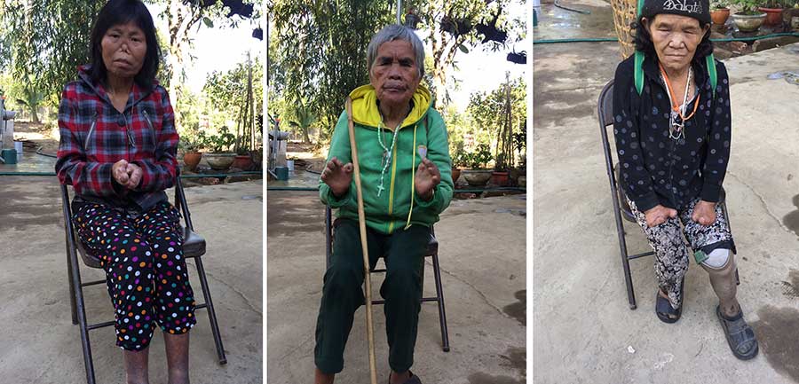 06 LEPEROUS PATIENTS 02